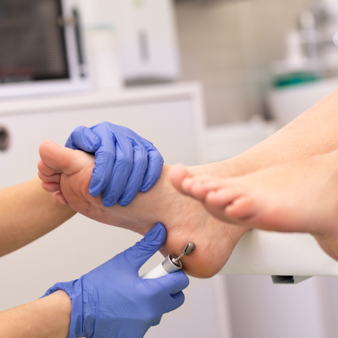 Avaliação preventiva em podologia